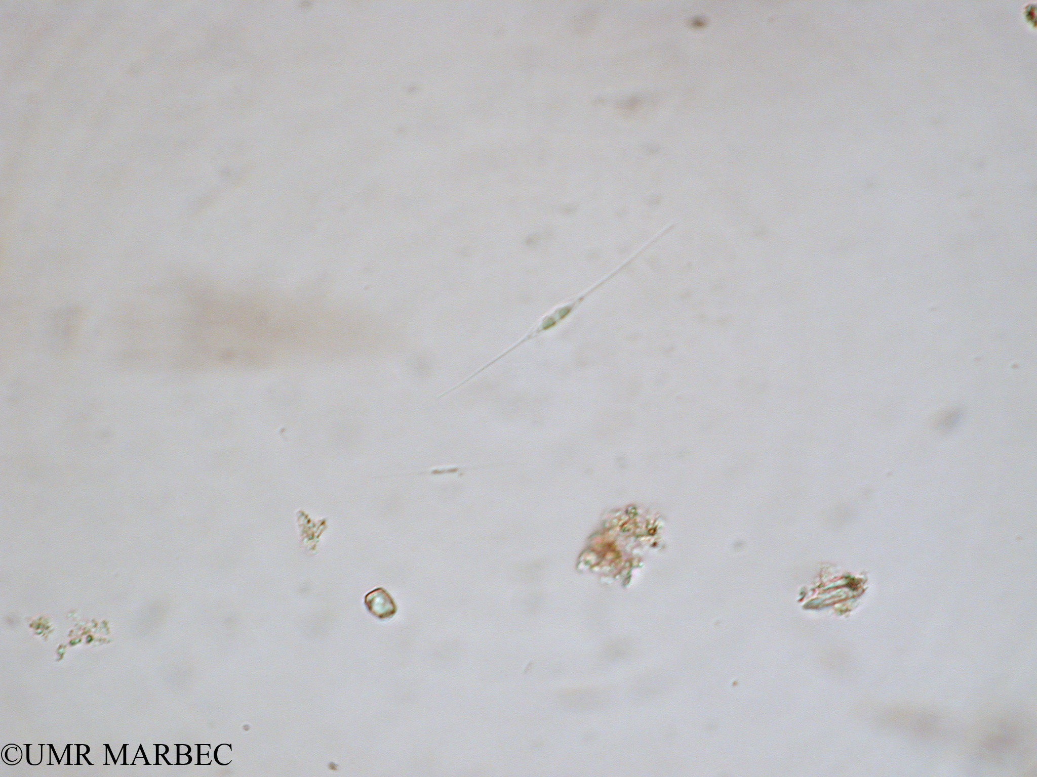 phyto/Tulear Lagoon/all/ICAR2 Avril 2008/Cylindrotheca closterium (Nitzschia sp6 x1.5x40)(copy).jpg